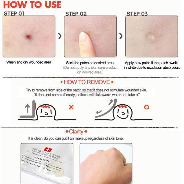 COSRX PIMPLE PATCH - 2 TYPES